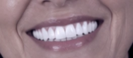 DENTÍSTICA ESTÉTICA - DENTISTA JARDIM PERI