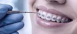 ORTODONTIA - DENTISTA JARDIM PERI