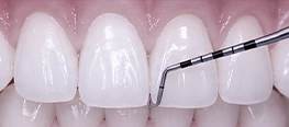 PERIODONTIA - DENTISTA JARDIM PERI