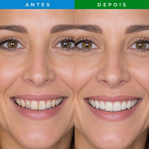 RESULTADO 2 - DENTISTA JARDIM PERI