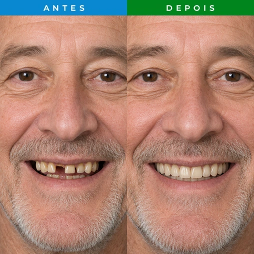 RESULTADO 3 - DENTISTA JARDIM PERI