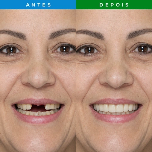 RESULTADO 4 - DENTISTA JARDIM PERI